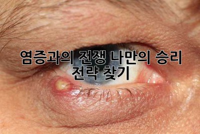 염증과의 전쟁, 나만의 승리 전략 찾기